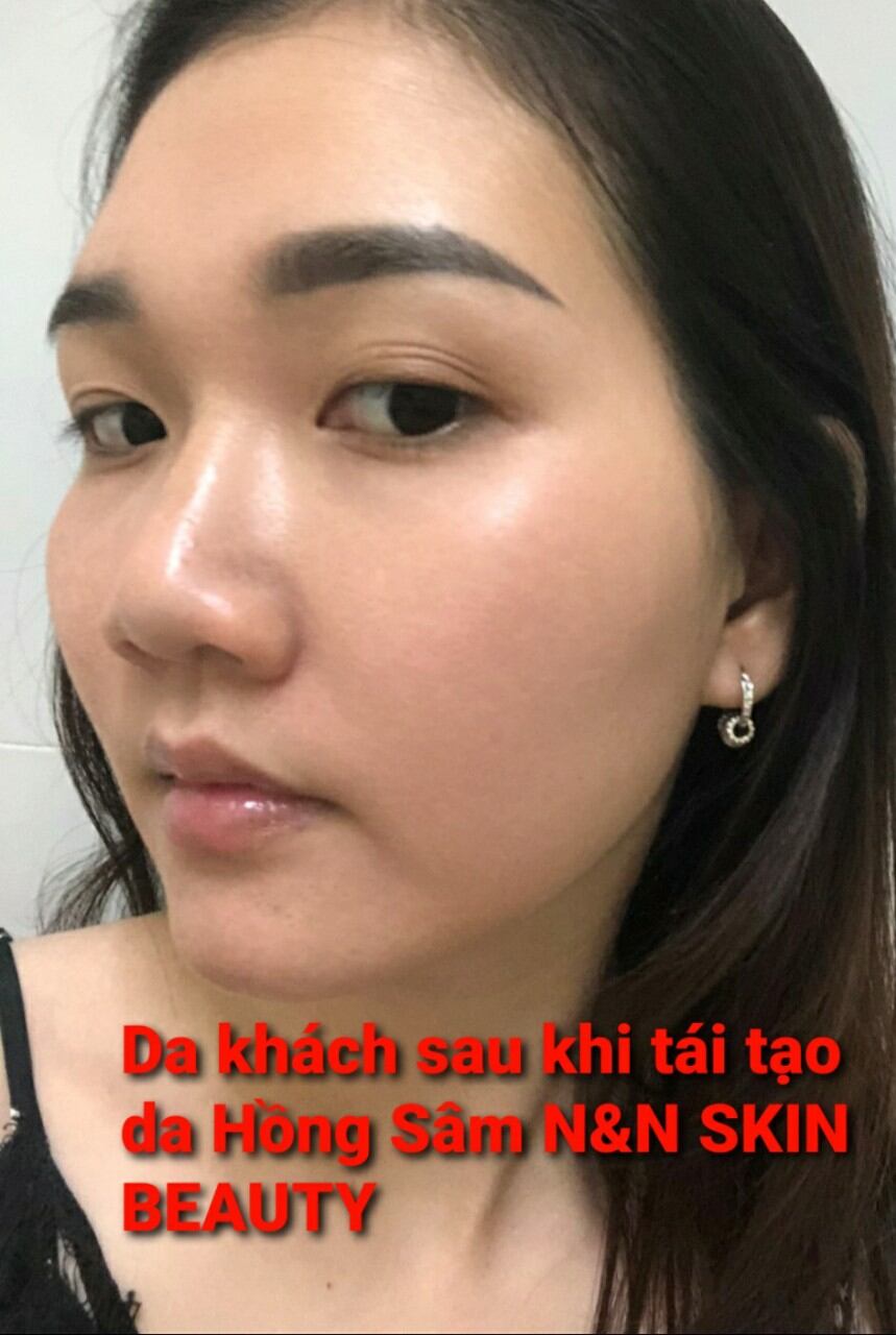 HỒNG SÂM TÁI TẠO