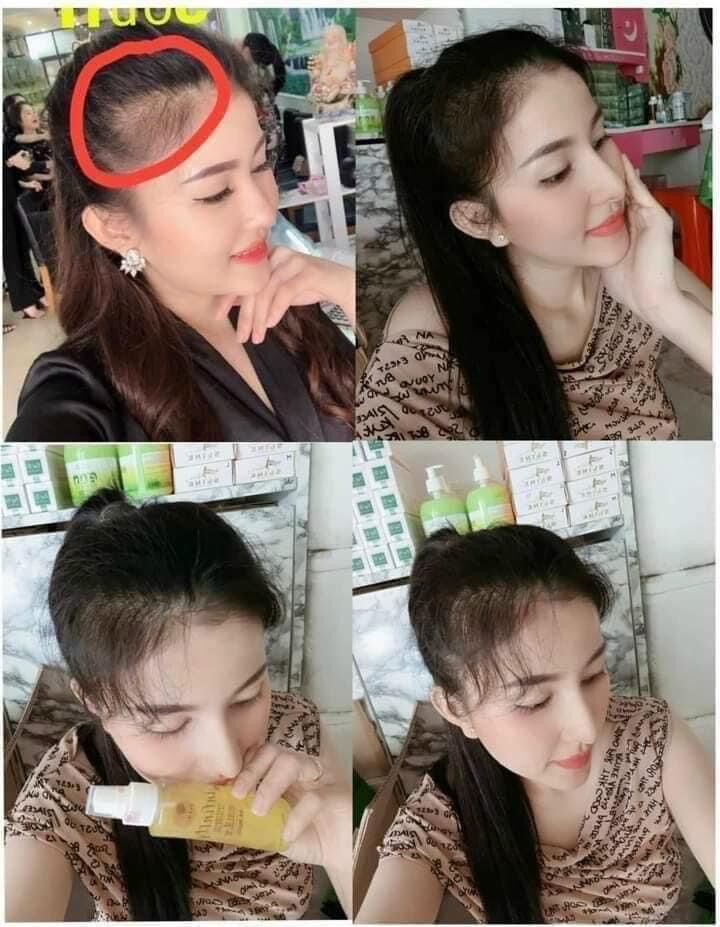 [Chính Hãng CTY 100%] Xịt Mọc Tóc Tinh Chất Sả Bưởi TUỆ VI INFINITY