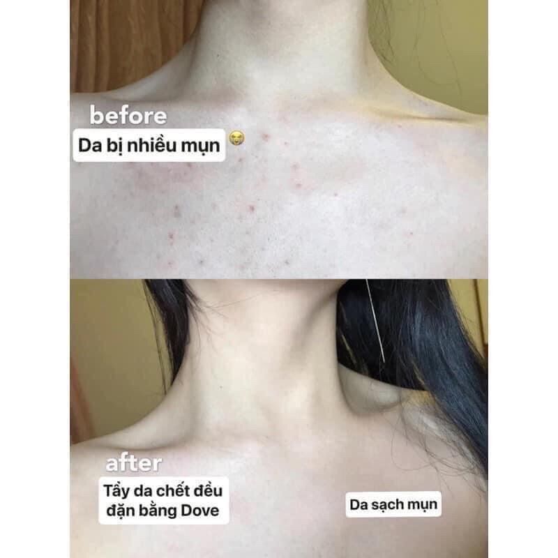 [ FULLSIZE AUTH ĐỨC] Siêu Thơm Siêu Thích Tẩy Da Chết Body Dove