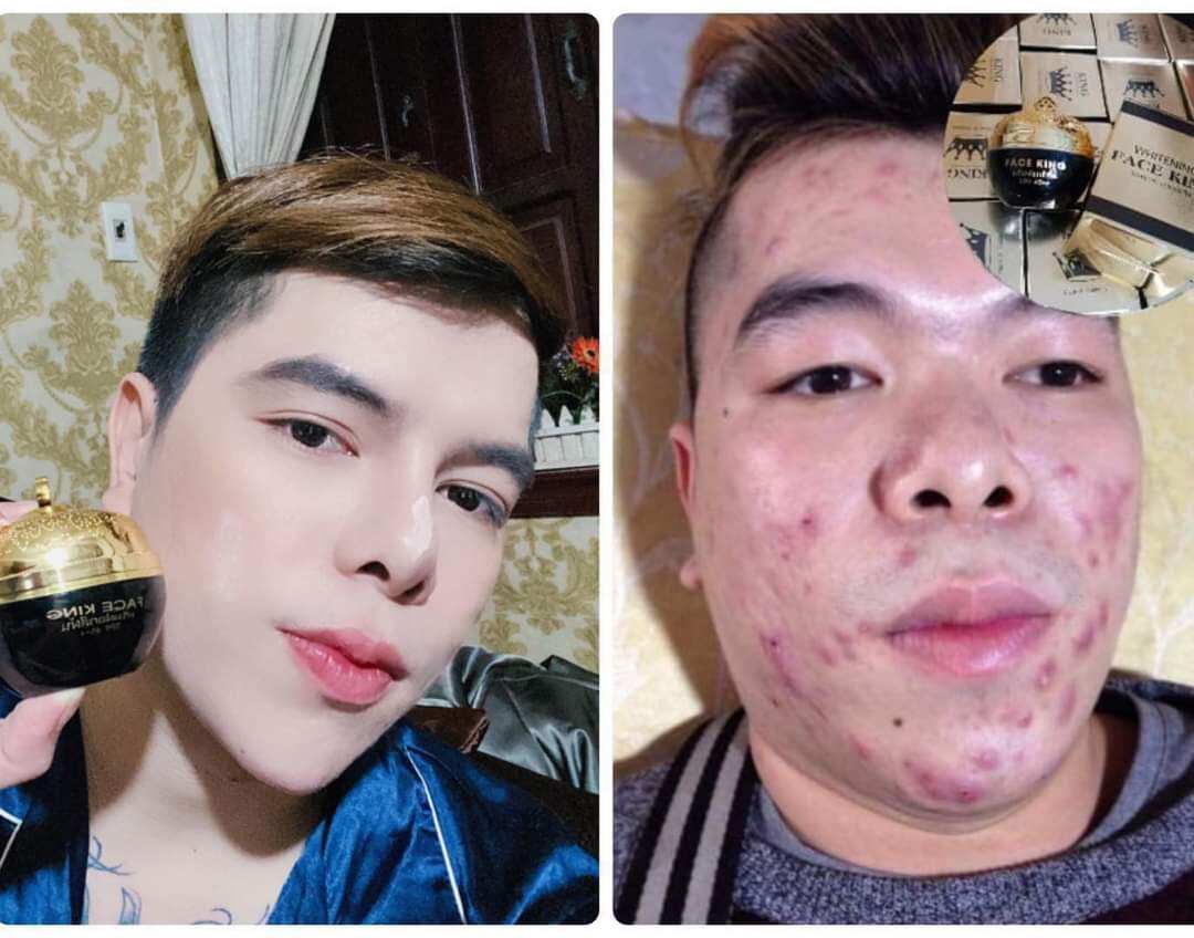 Kem face king 5 in 1 thai lan