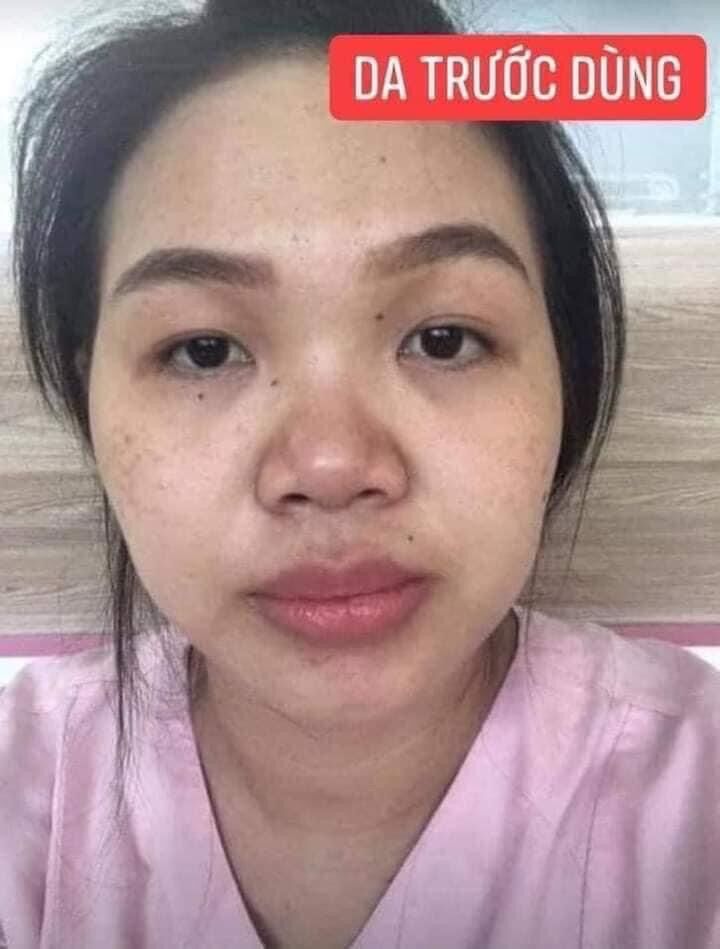 Kem nám huyền phi