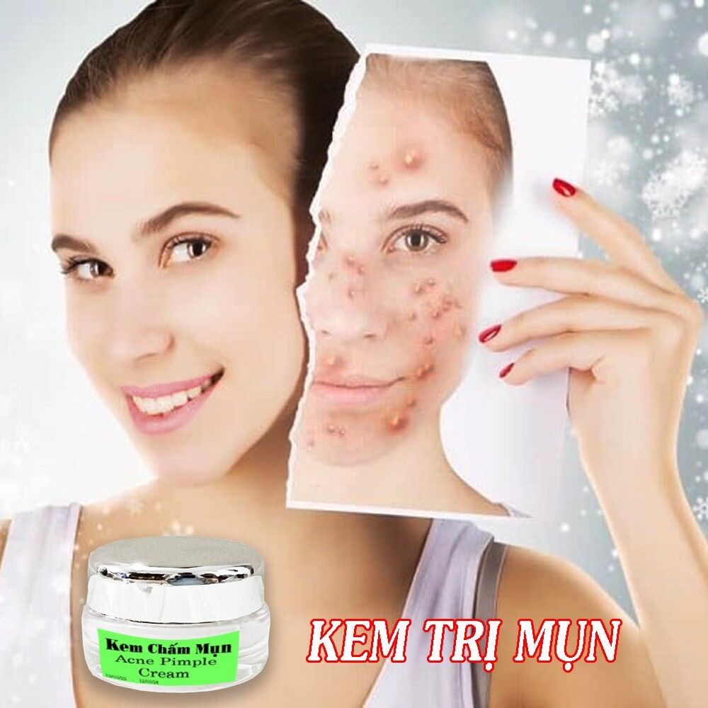 Kem Chấm Mụn Xẹp Nhanh Mụn Bọc,Mụn Viêm