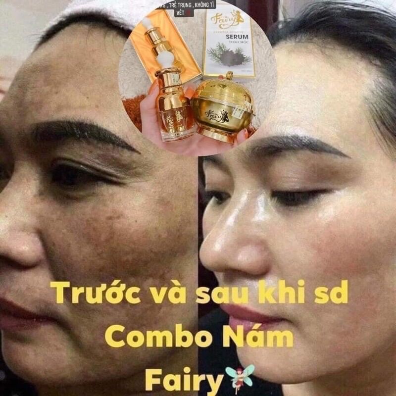 Kem Dưỡng Trắng Da Fairy Cao Cấp