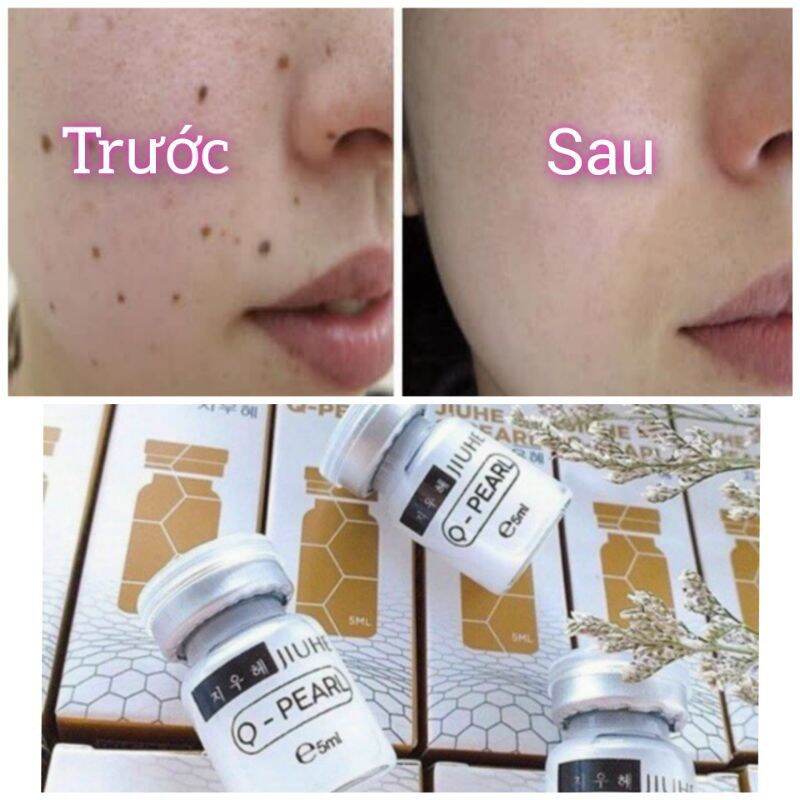 Serum Trị Thâm Mụn Thâm Nách Jiuhe Hàn Quốc 💯 (Cam Kết Chính Hãng)