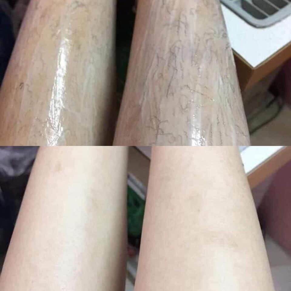 Hạt sang hạt sành dạ dày mua 2 tặng 1