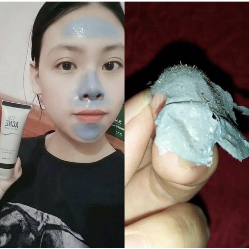 Gel lột mụn Dr acne chính hãng