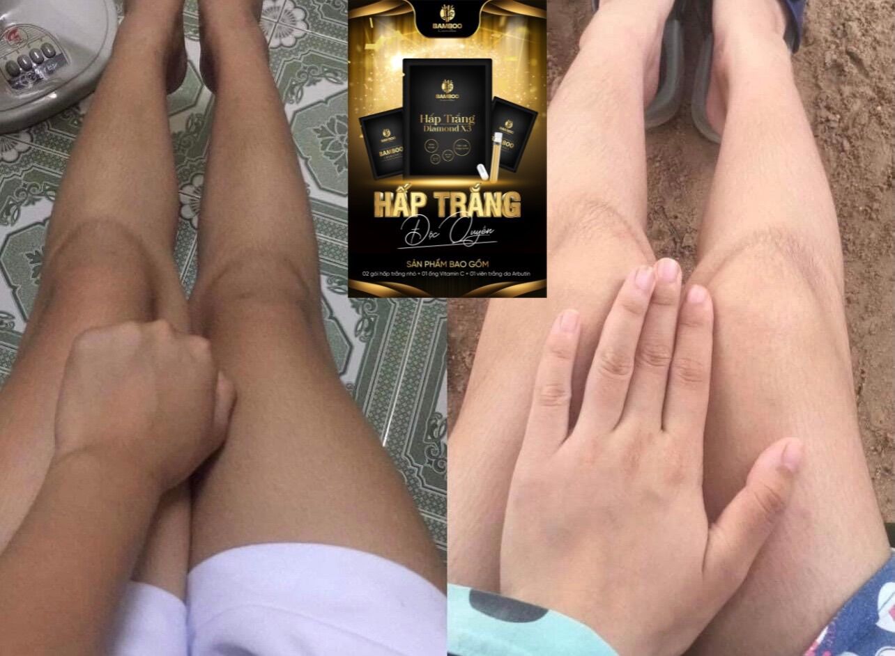 (COMBO 3 Tặng 1) Hấp Trắng Bamboo - Dùng cho Body & Face