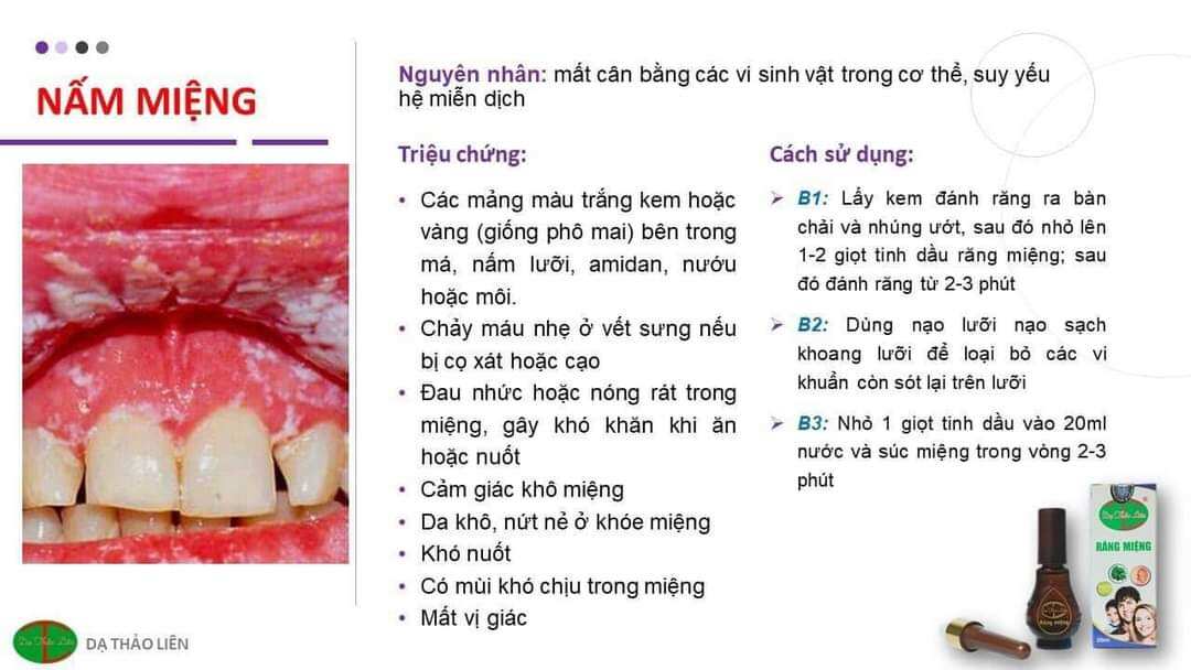 Tinh dầu răng miệng Dạ Thảo Liên
