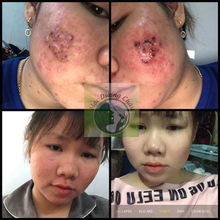 Combo bột rửa mặt + tái tạo Mộc Dương Châu