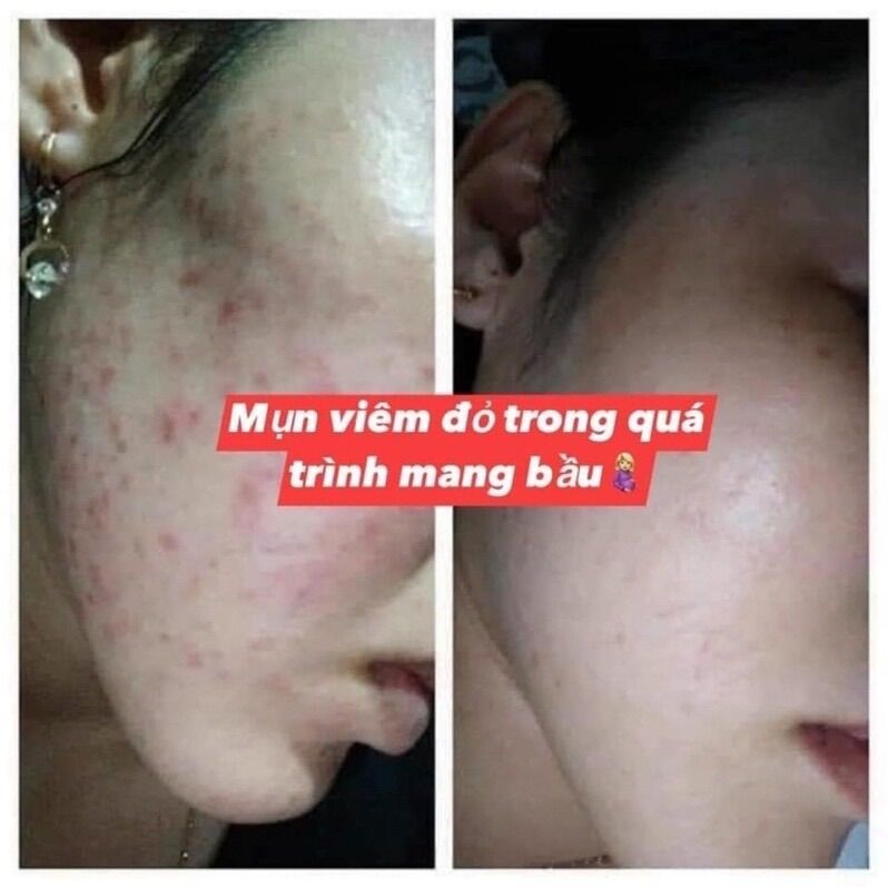 Kem Dữơng Trắng Sáng Da Face Queen Mini