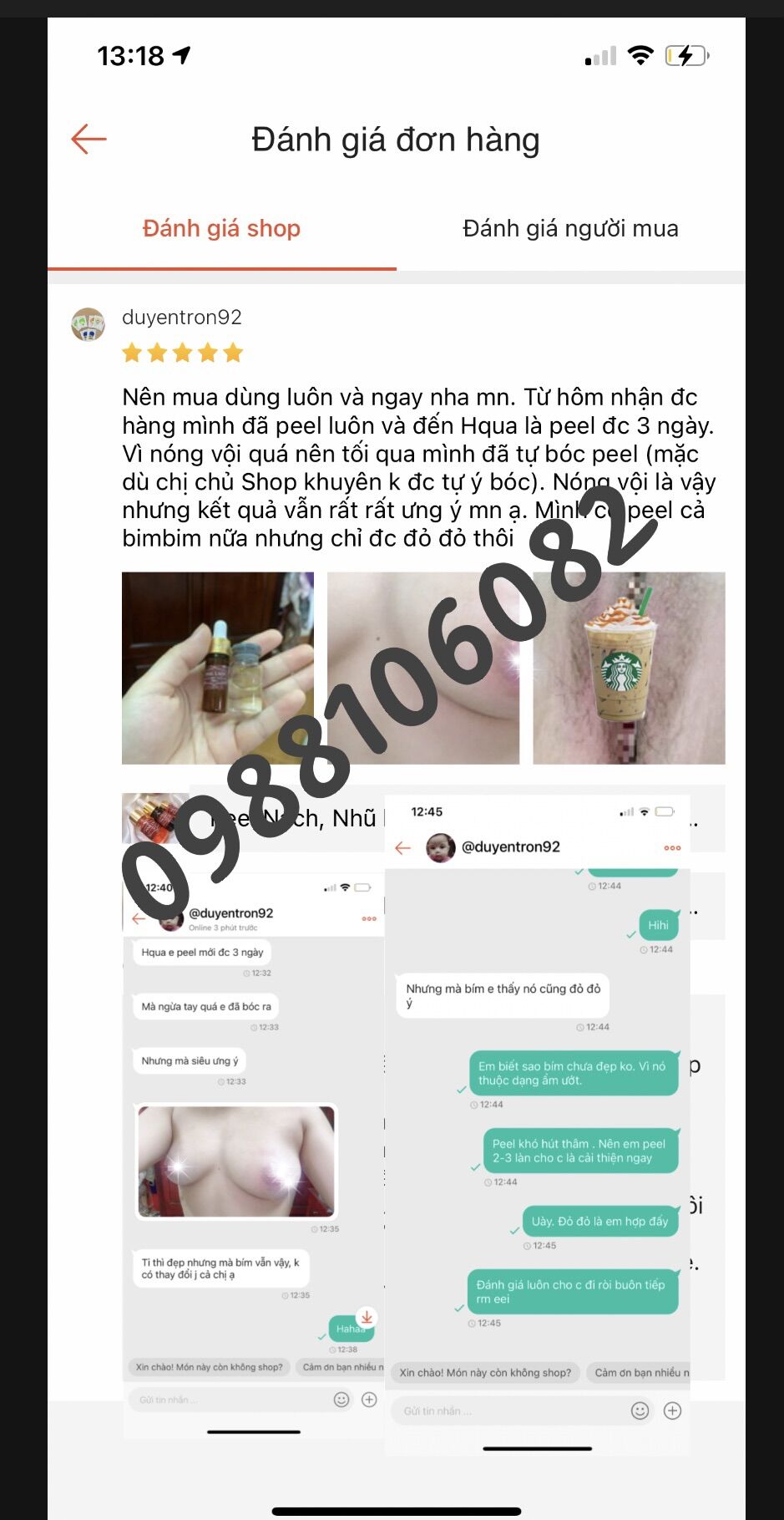 Peel làm mờ thâm nhũ hoa, nách, bikini