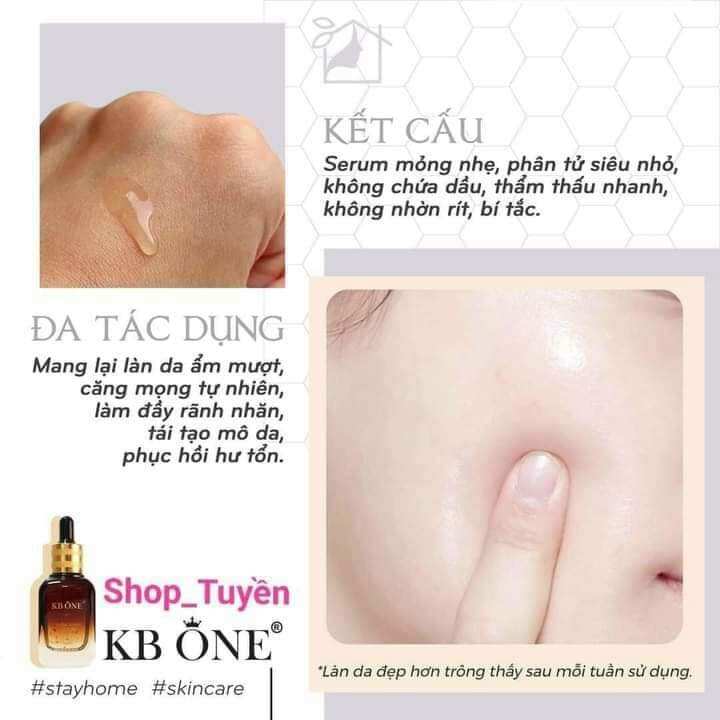 Serum Trắng Da KBONE.40ml