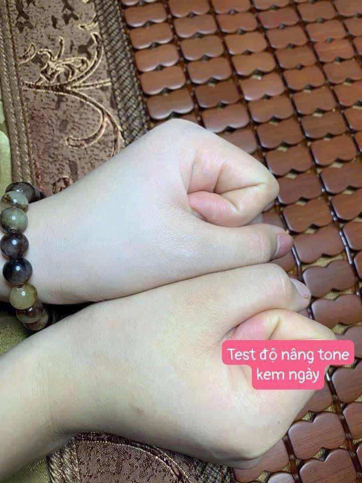 𝐊𝐞𝐦 𝐍𝐠𝐚̀𝐲 𝐃𝐫 𝐒𝐡𝐞𝐞 - 𝐃𝐮̛𝐨̛̃𝐧𝐠 𝐓𝐫𝐚̆́𝐧𝐠 𝐃𝐚 𝐁𝐚𝐧 𝐍𝐠𝐚̀𝐲.