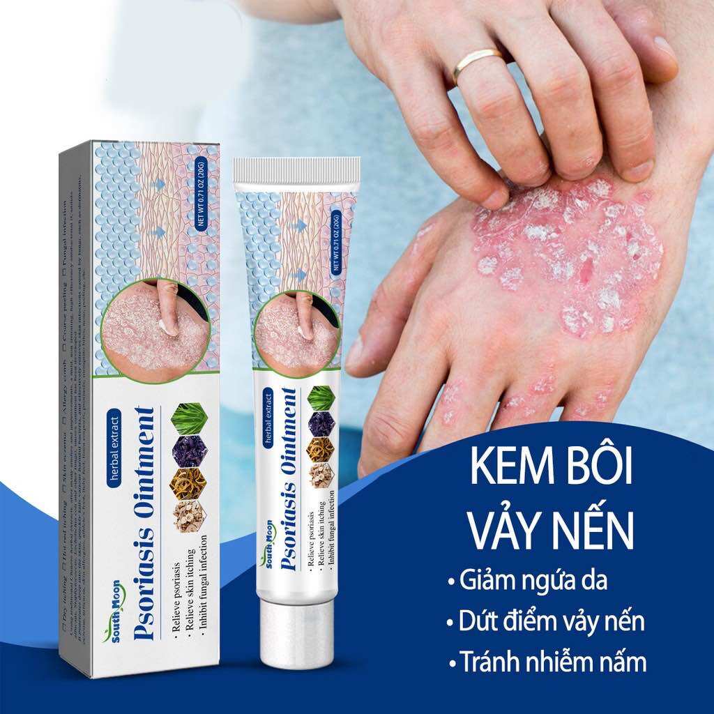Kem bôi thảo dược South Moon giảm nấm ngứa, vẫy nến, …