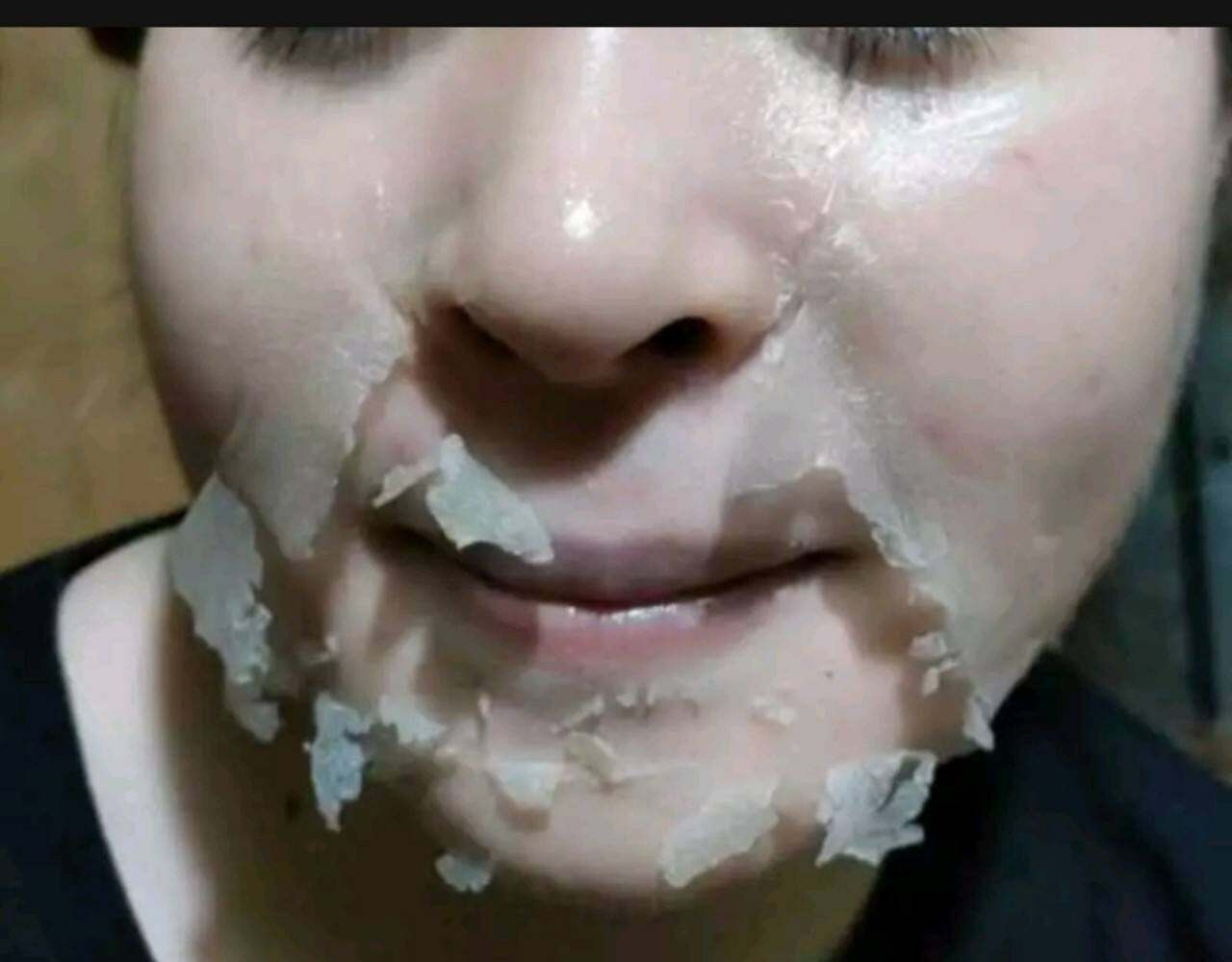 Peel tảo dùng lột nách, da mặt, peel body khử thâm body (1 chai)