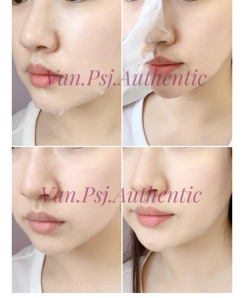 MẶT NẠ WONJIN MẪU MỚI