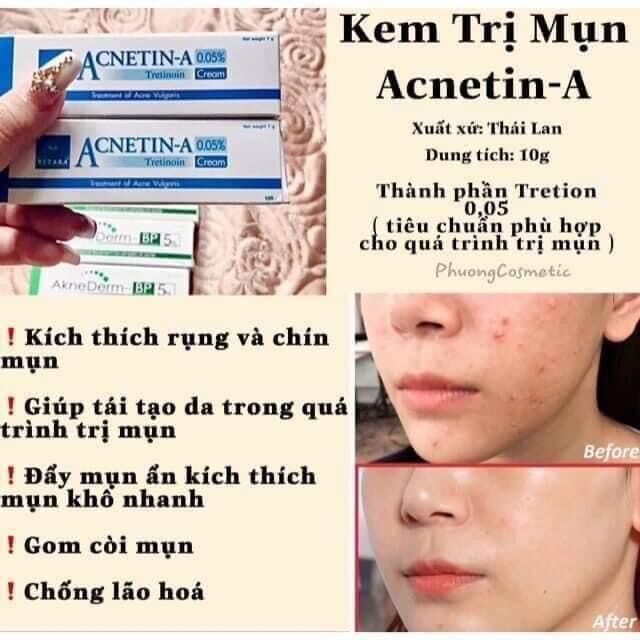 kem bôi mụn acnetin a 0,05# thái lan