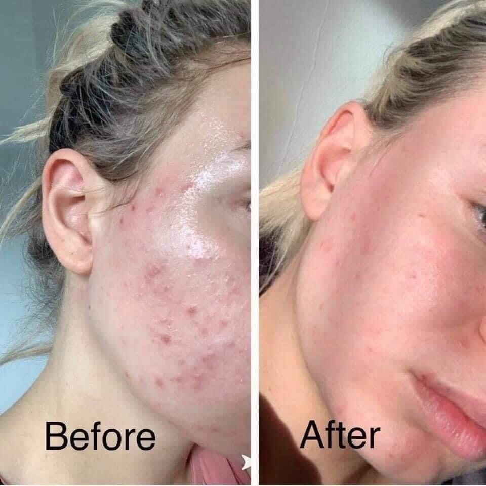 Sữa rửa mặt Cerave dịu nhẹ, sạch sâu