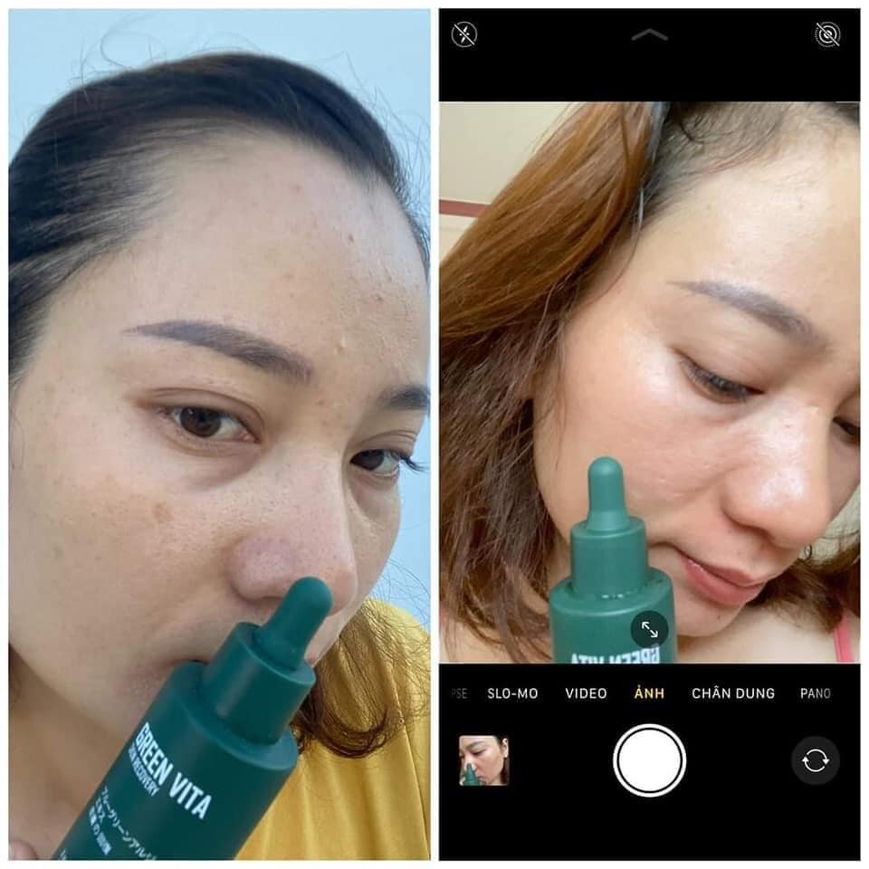 Combo Tái Sinh Da Green Vita (1 Serum và 1 Bột Rửa Mặt)