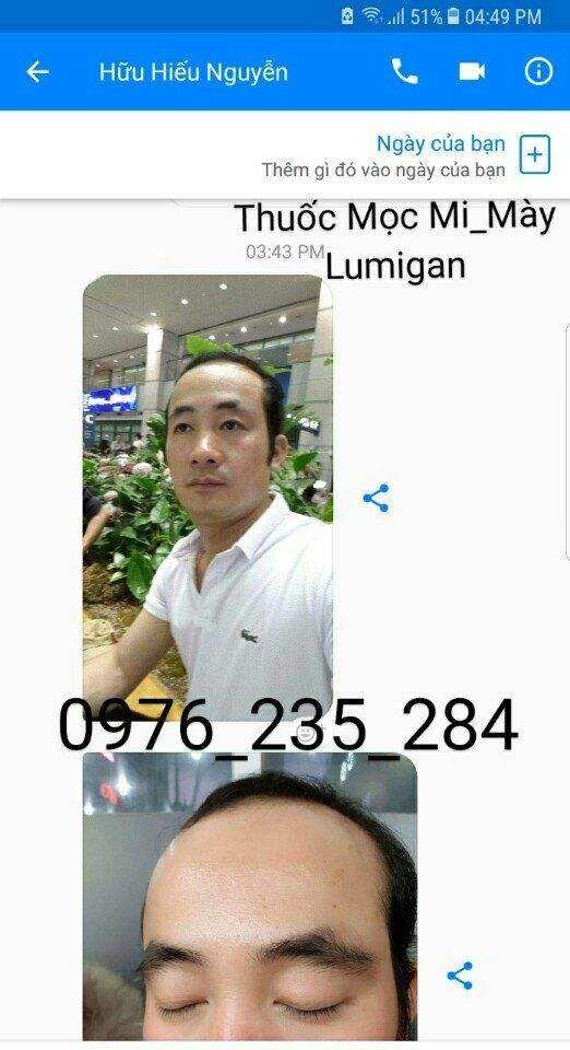 LUMIGAN MỌC LÔNG MÀY