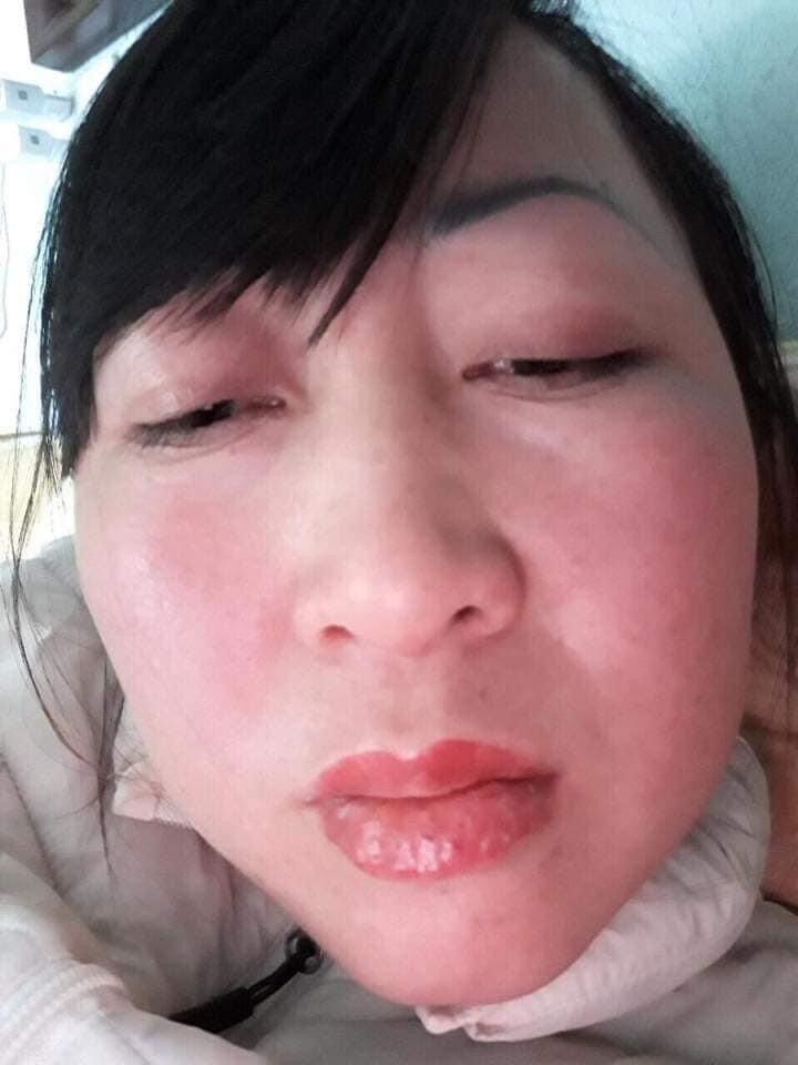 Dưỡng Vaseline Rose Mụn Nước Môi Sau Xăm
