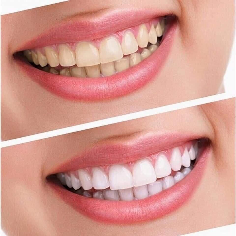 Kem đánh răng Crest 3D White Pro Advanced Whitening 147g của Mỹ