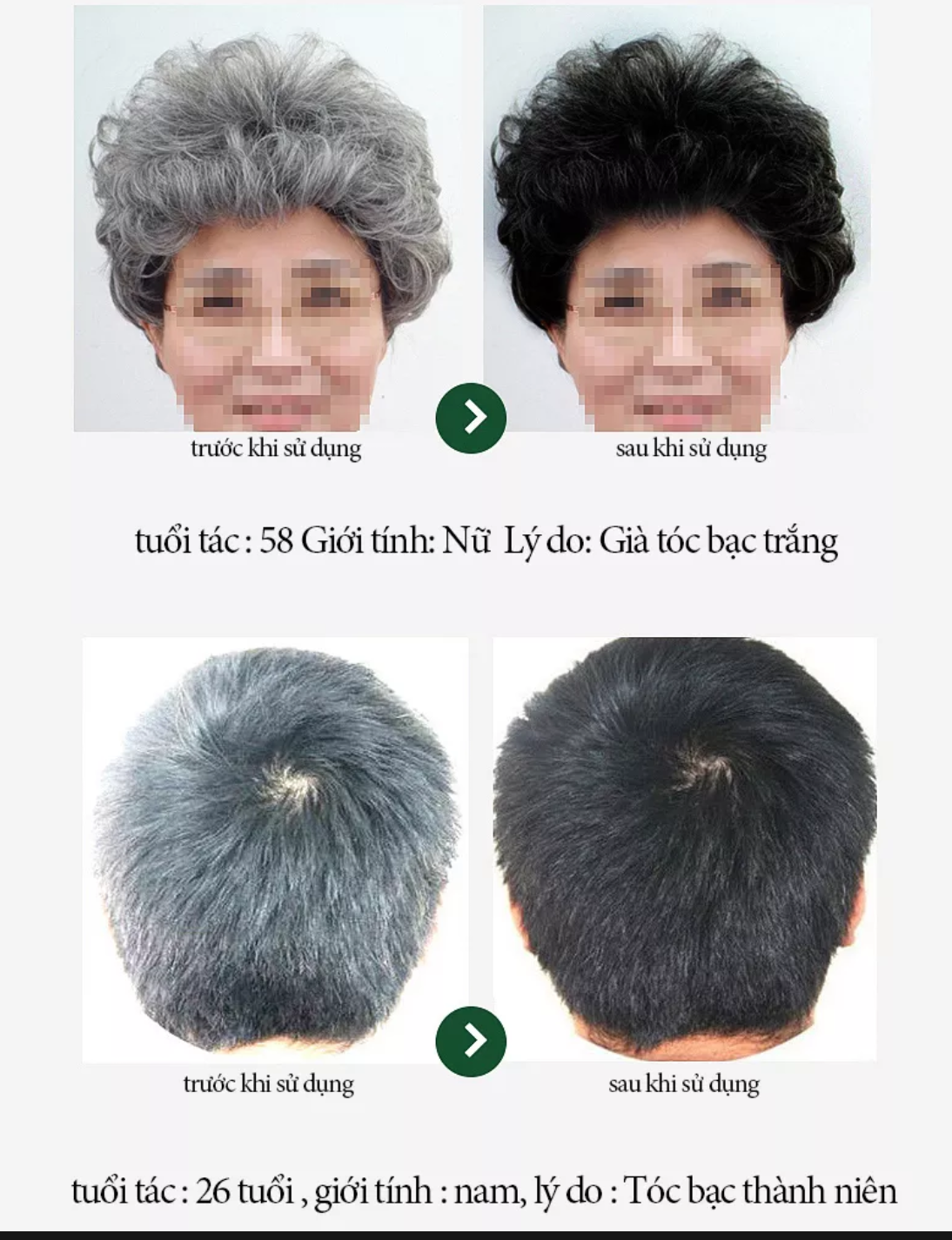 CHAI XỊT ĐEN TÓC DƯỠNG TÓC CAM KẾT HIỆU QUẢ HÀNG LOẠI TỐT