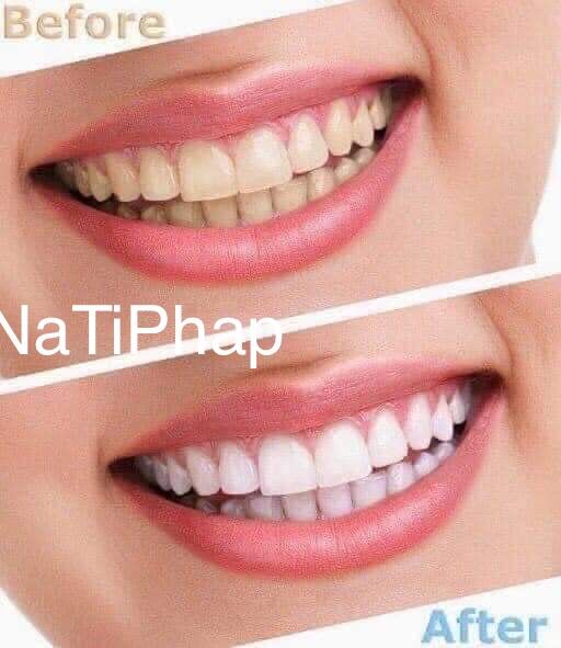 Kem đánh răng ORAL B PRO EXPERT 75ml