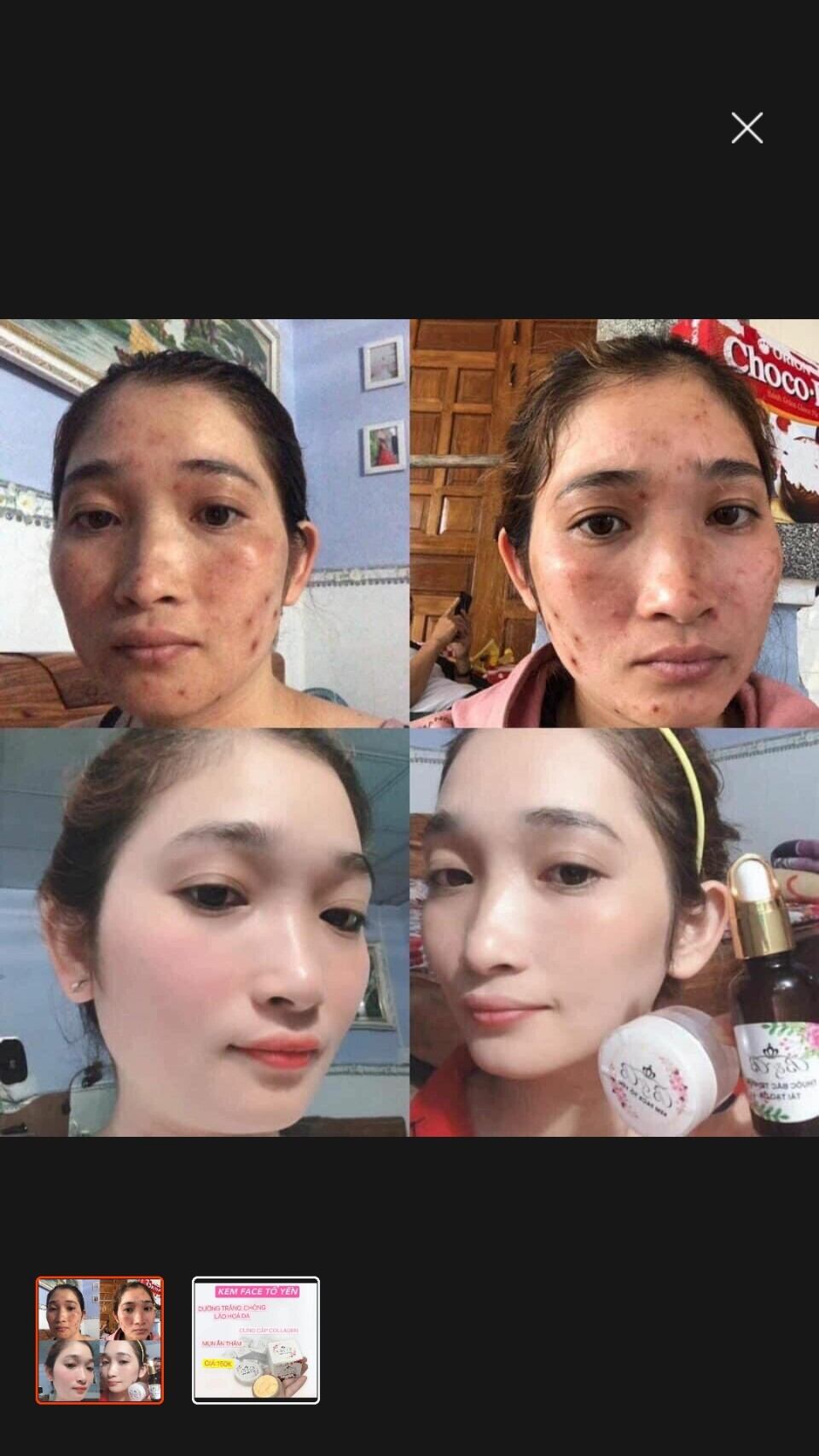Kem face tổ yến B&B