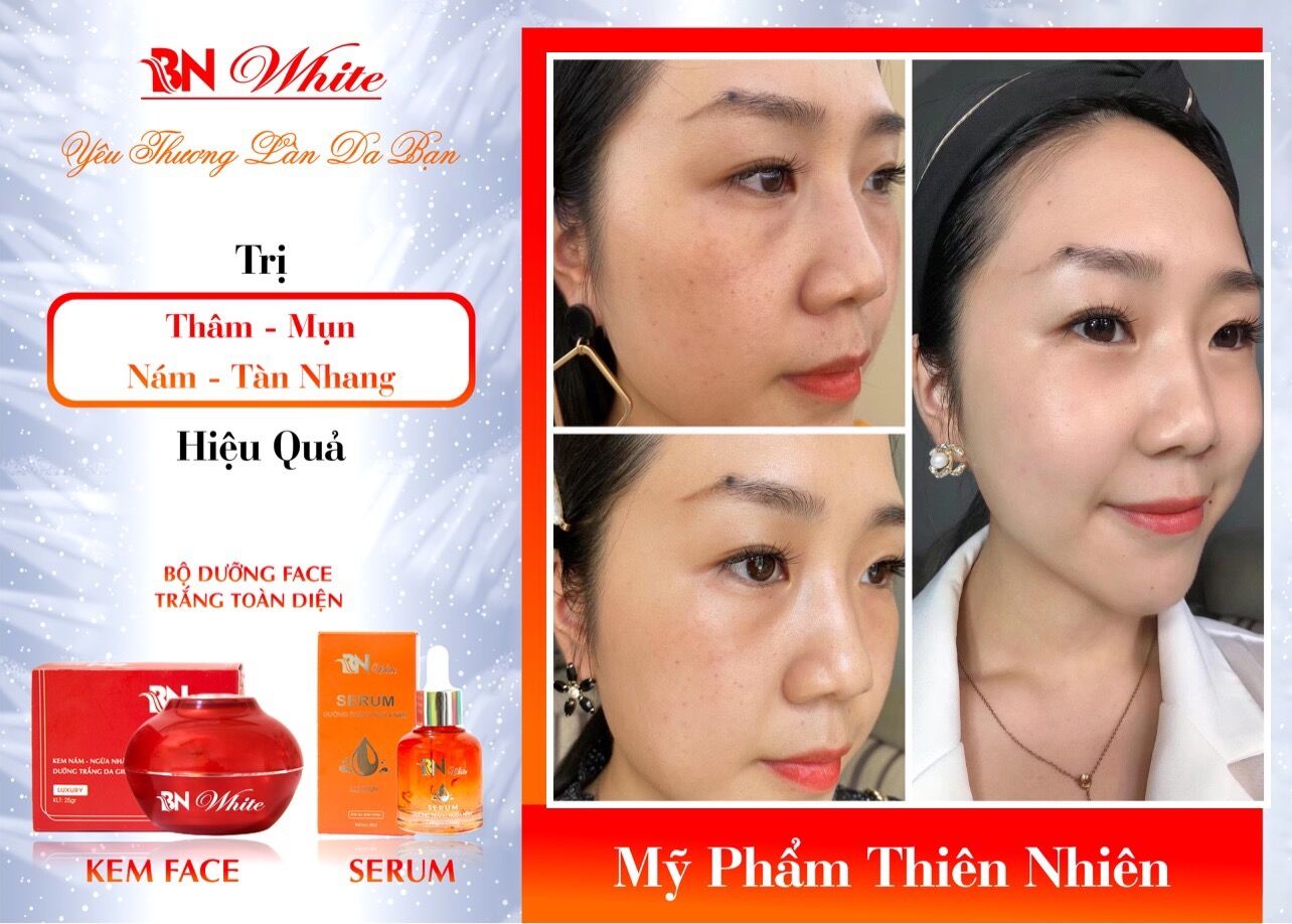 [HCM]DƯỠNG DA TRẮNG SÁNG - MỜ NÁM BN WHITE