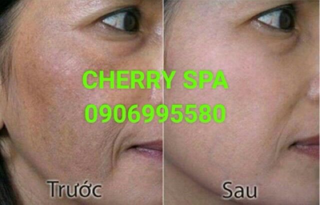 Kem kỳ tế bào chết Oly HT 70g