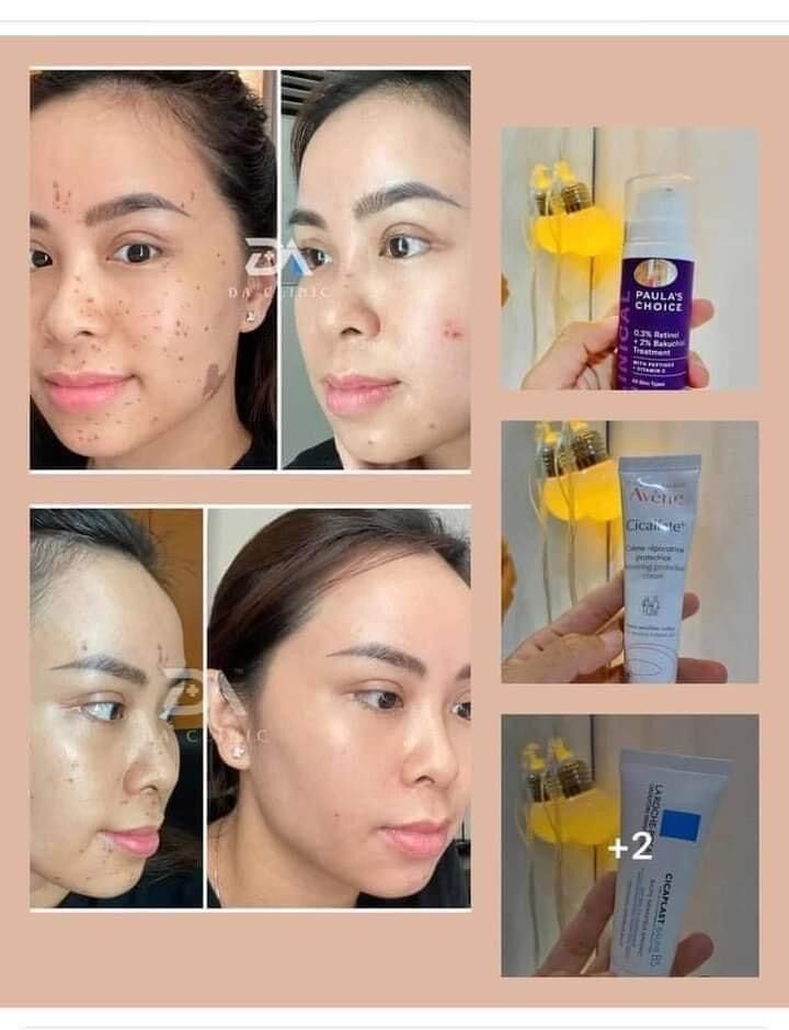 [Đủ Bill] kem dưỡng phục hồi Avene 100ml