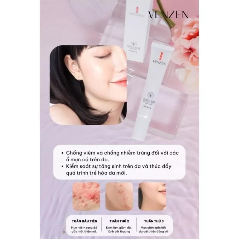 Tuýp kem giảm mụn của bioaqua