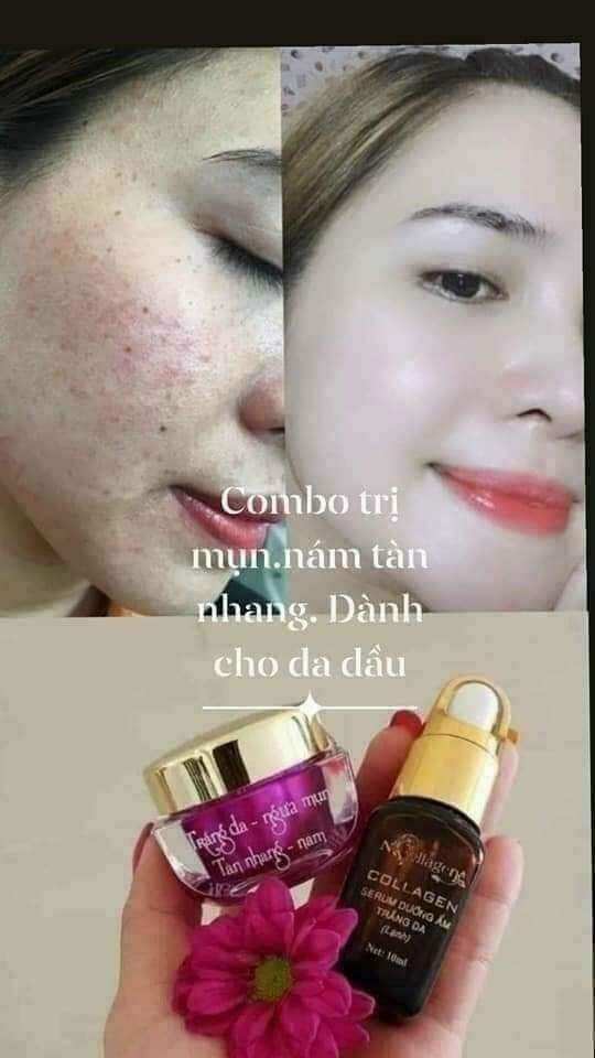 SERUM LẠNH NCOLAGEN 10ML
