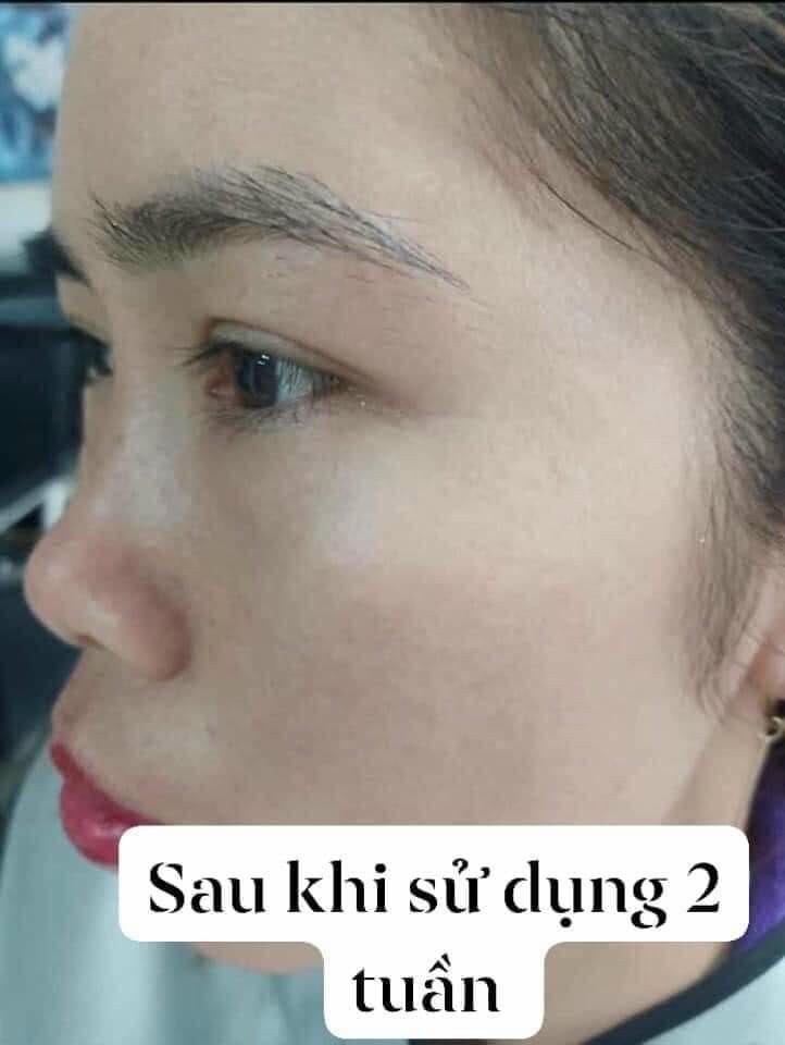 Cao Nám Hoàng Cung Magic skin (hộp 13g)