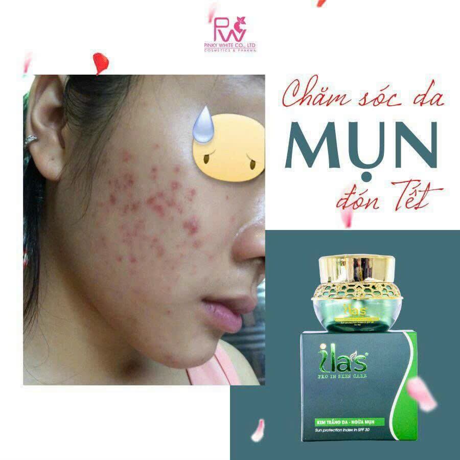 Kem Ilas Giảm Mụn Thâm ,Trắng Da _ Kem ILAS ,20gram