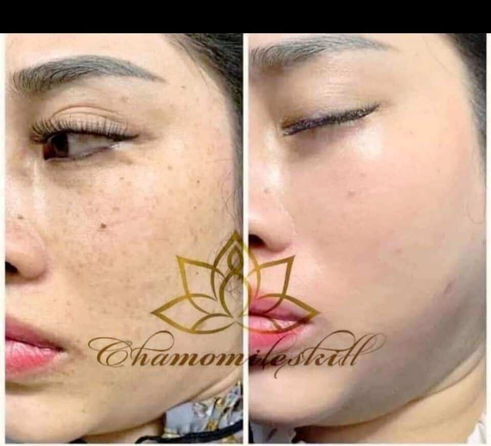 Kem tái tạo vàng Chamomile skill
