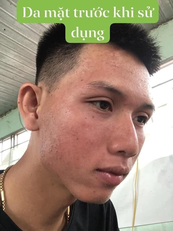 TÁi TẠO DA MỘC DƯƠNG CHÂU 30ML