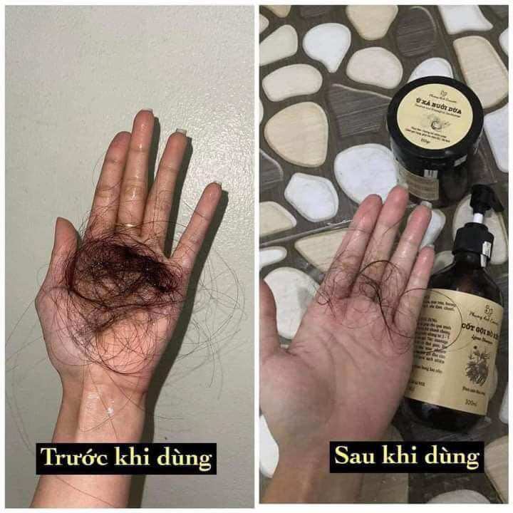 COMBO CỐT GỘI BỒ KẾT PHƯƠNG ANH COSMETICS