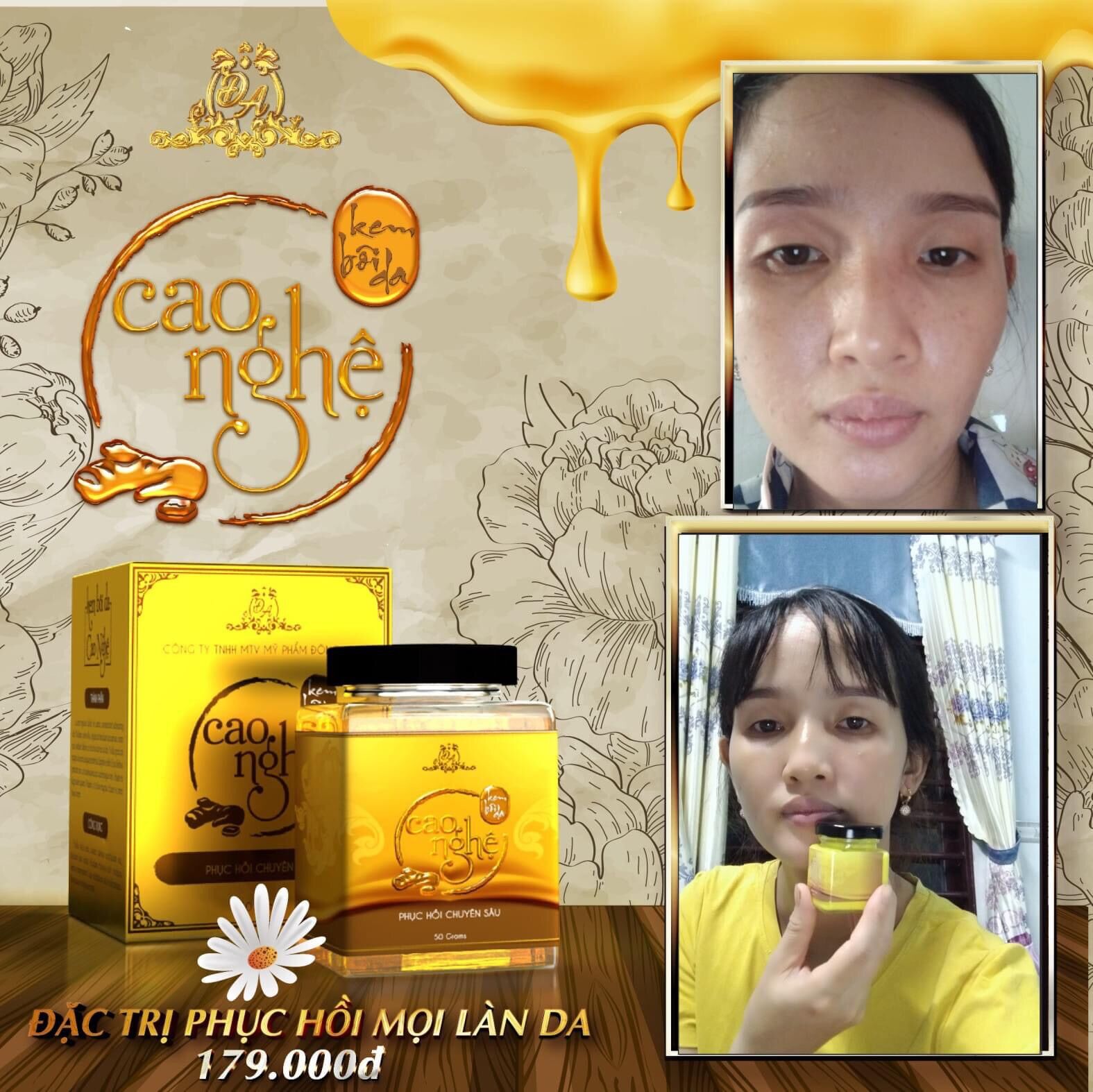 Cao nghệ Collagen X3 Đông Anh
