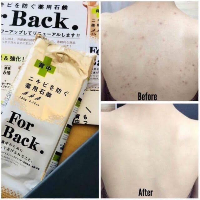 Xà phòng, xà bông giảm mụn lưng For Back Nhật Bản