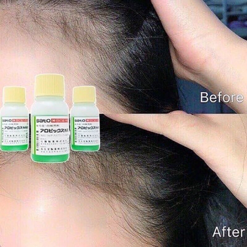 Tinh chất Kích Thích Mọc Tóc Thảo Dược Sato Arovics Nhật Bản 30ml