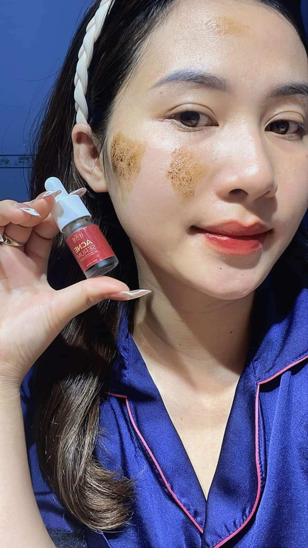 Chấm mụn Acne Serum Diếp cá (5ml) _Hoangthiensamshop