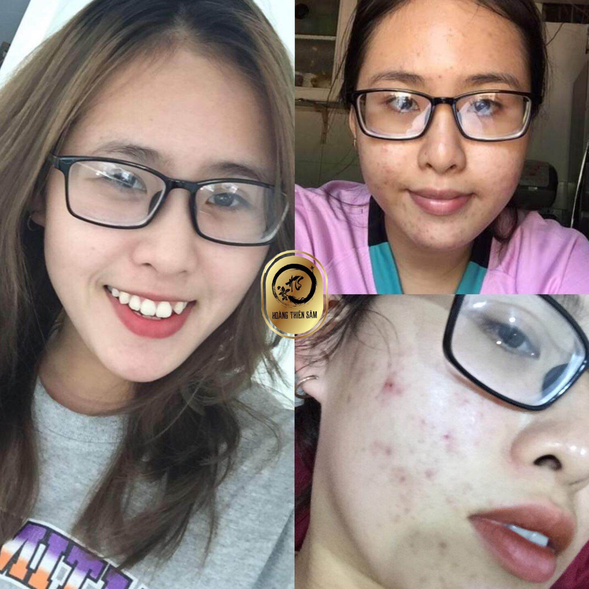 Combo Bột + Tái Tạo Da Hoàng Thiên Sâm 100gr + 30ml