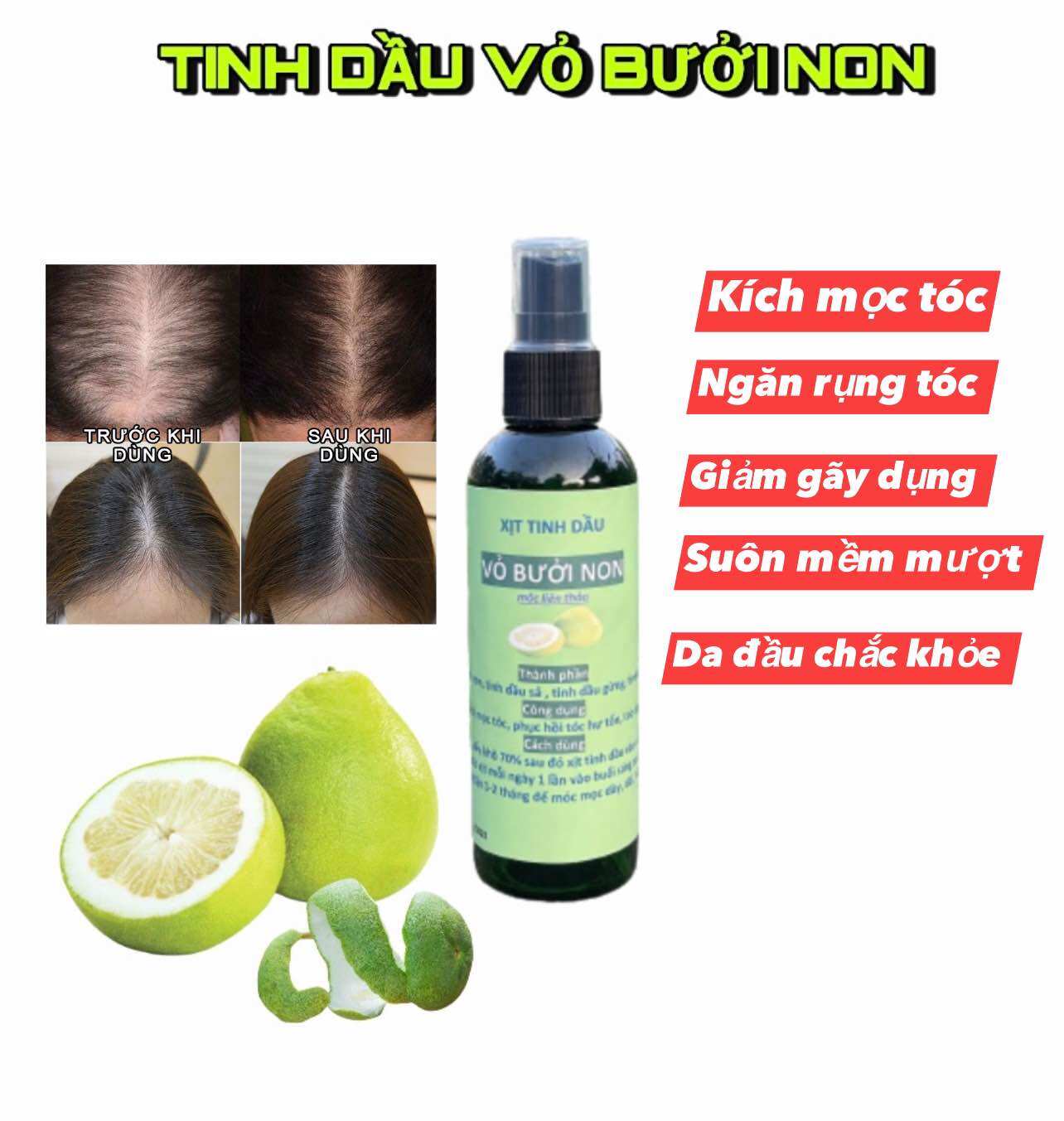 Xịt mọc tóc tinh dầu vỏ bưởi non 100 ml - Ngăn ngừa rụng tóc, kích mọc tóc, cung cấp dưỡng chất c