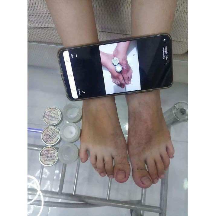 THẢO MỘC BÔI DA TRẦN KIM HUYỀN