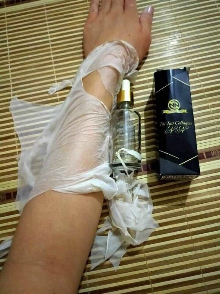 Lột da NN tái tạo da mới trắng sáng