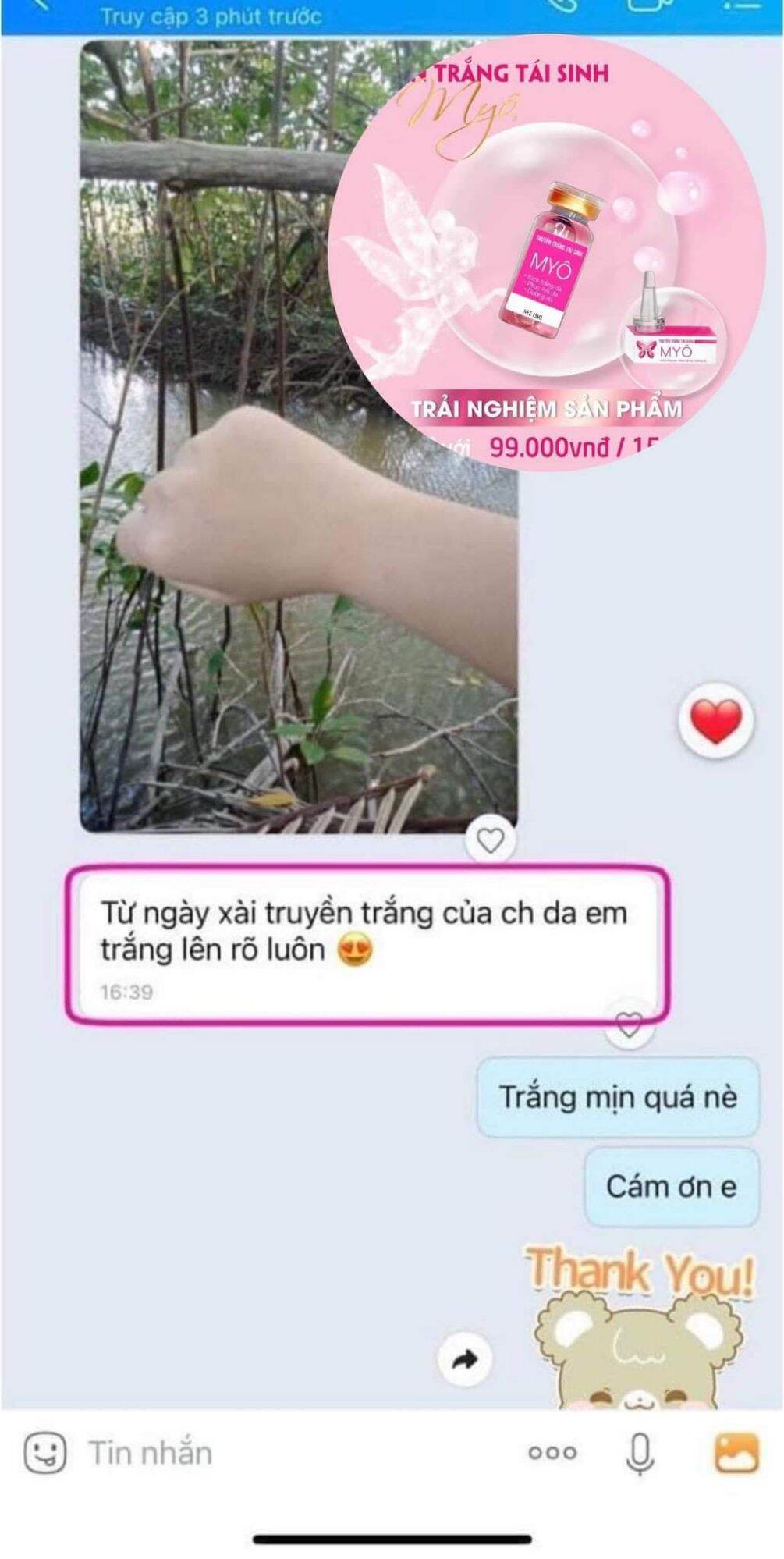 Combo Set Kích Trắng & Truyền Trắng MyÔ
