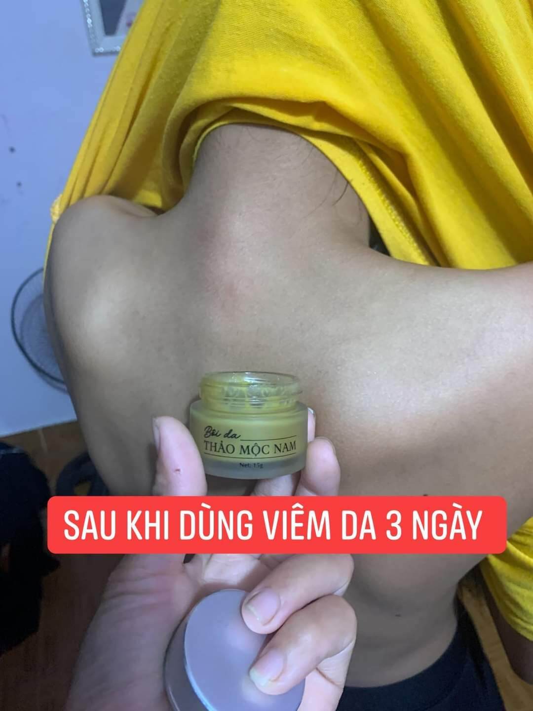 Kem bôi da Thảo Mộc Nam - Mẫu mới 15gr