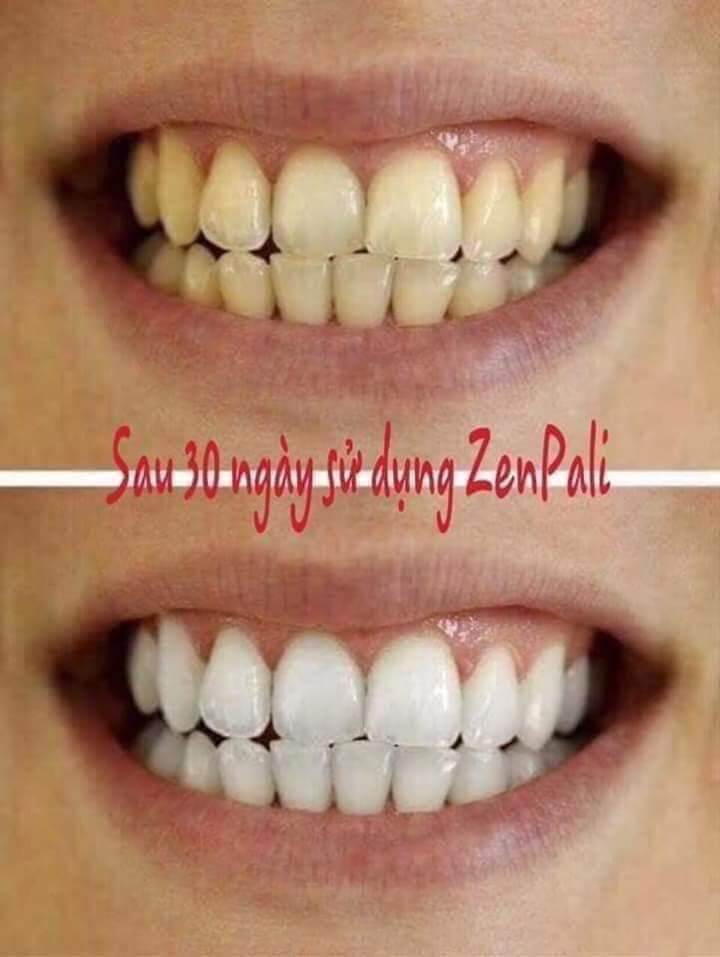 [HCM]THAN HOẠT TÍNH TRẮNG RĂNG MY SMILE